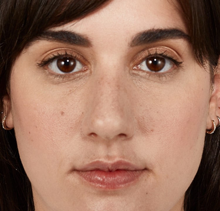 complexion after
